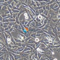 hey人卵巢癌细胞