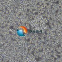 KHYG-1人NK细胞淋巴瘤细胞