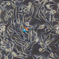 SK-MEL-5人皮肤恶性黑色素瘤