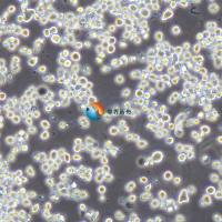 RPMI-8226人多发性人骨髓瘤细胞