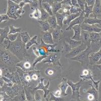 HCC1954人乳腺癌细胞