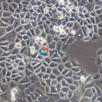 IOSE-80人正常卵巢上皮细胞