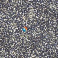 NCI-H3122人非小细胞肺癌细胞