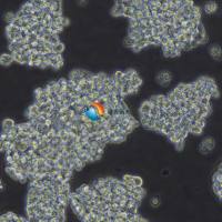 Y79人视网膜母细胞瘤细胞