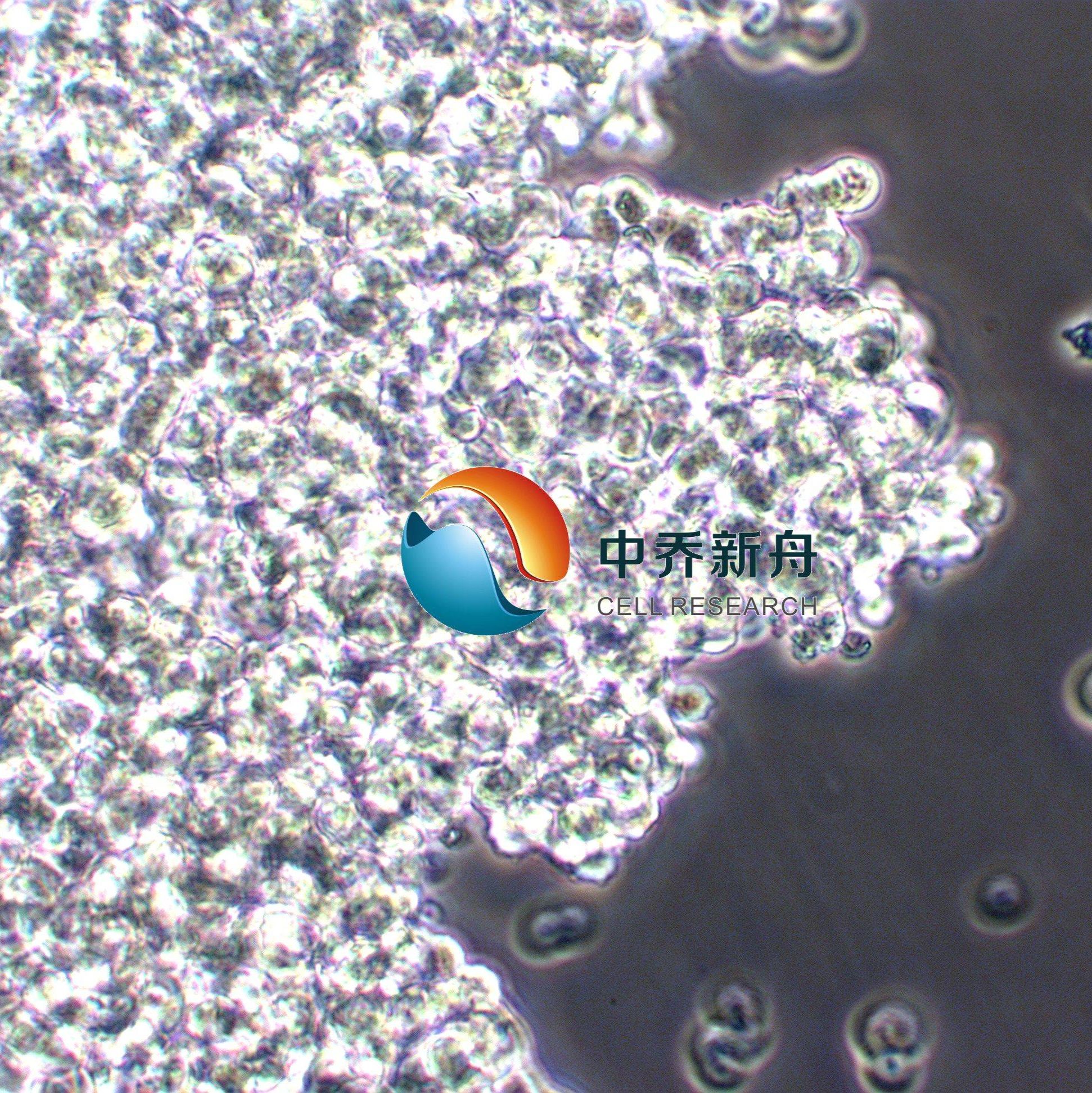 NCI-H146人小细胞肺癌细胞
