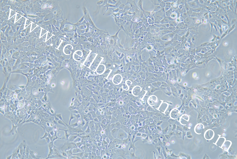 TE-10细胞 | TE10细胞 | TE-10 | TE1