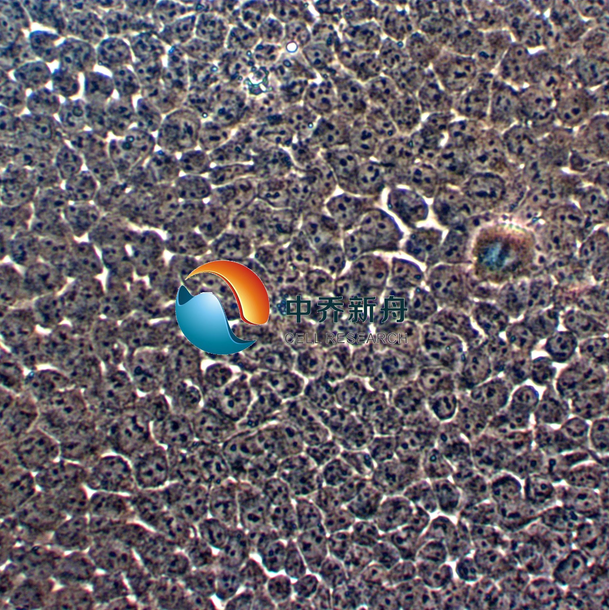 SACC-LM涎腺腺样囊性癌细胞