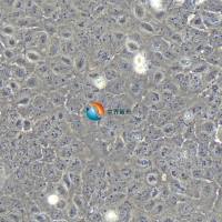 OVCAR-8人卵巢癌腺癌细胞