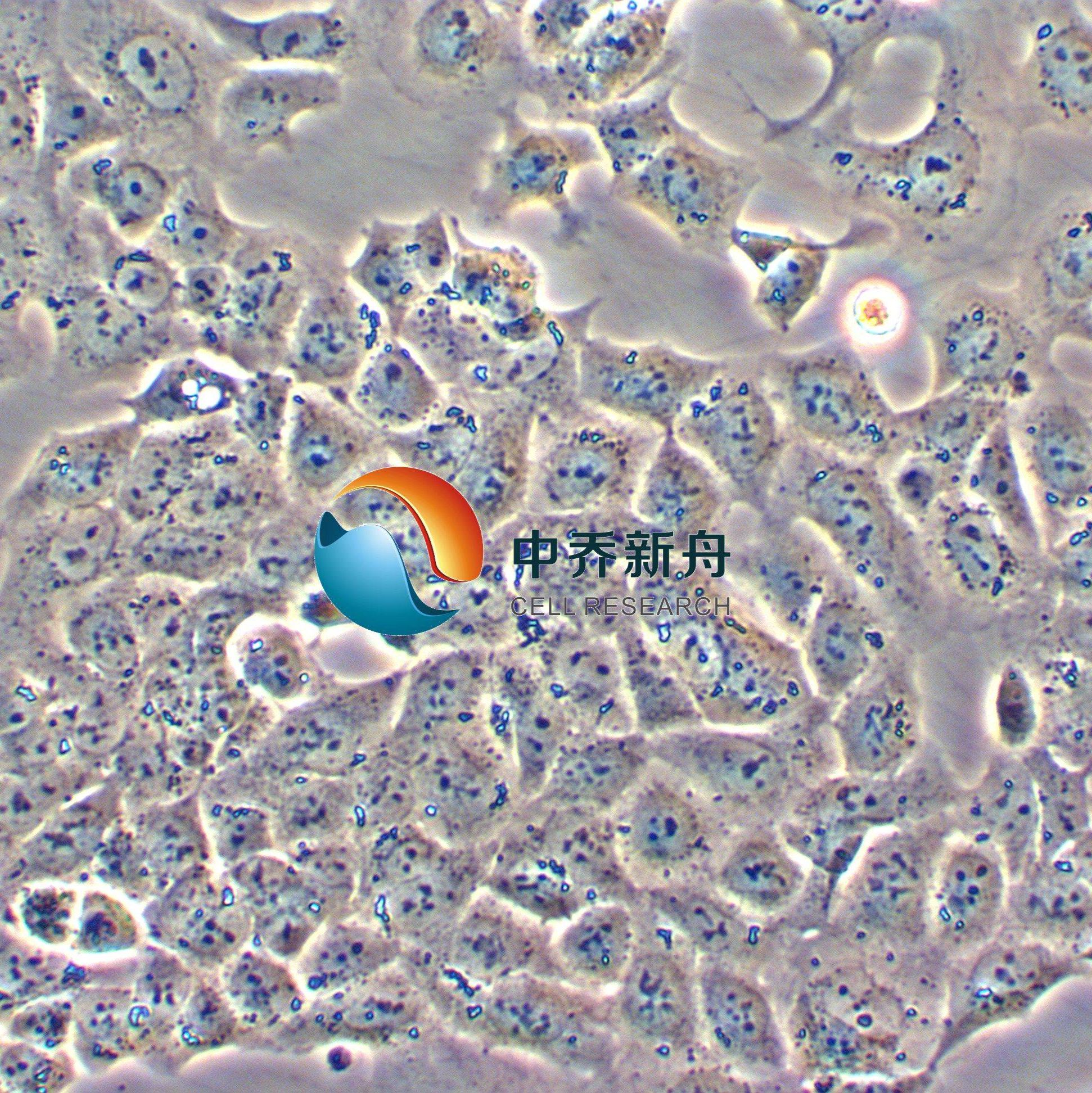RPMI2650人鼻中隔鳞状癌细胞
