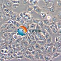 RPMI2650人鼻中隔鳞状癌细胞