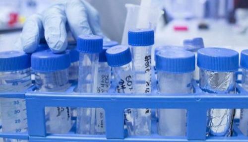 PCR扩增电泳结果图的分析步骤和注意事项‌