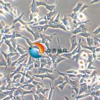 SNU-638人胃癌细胞