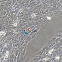 MET-5A人间皮细胞