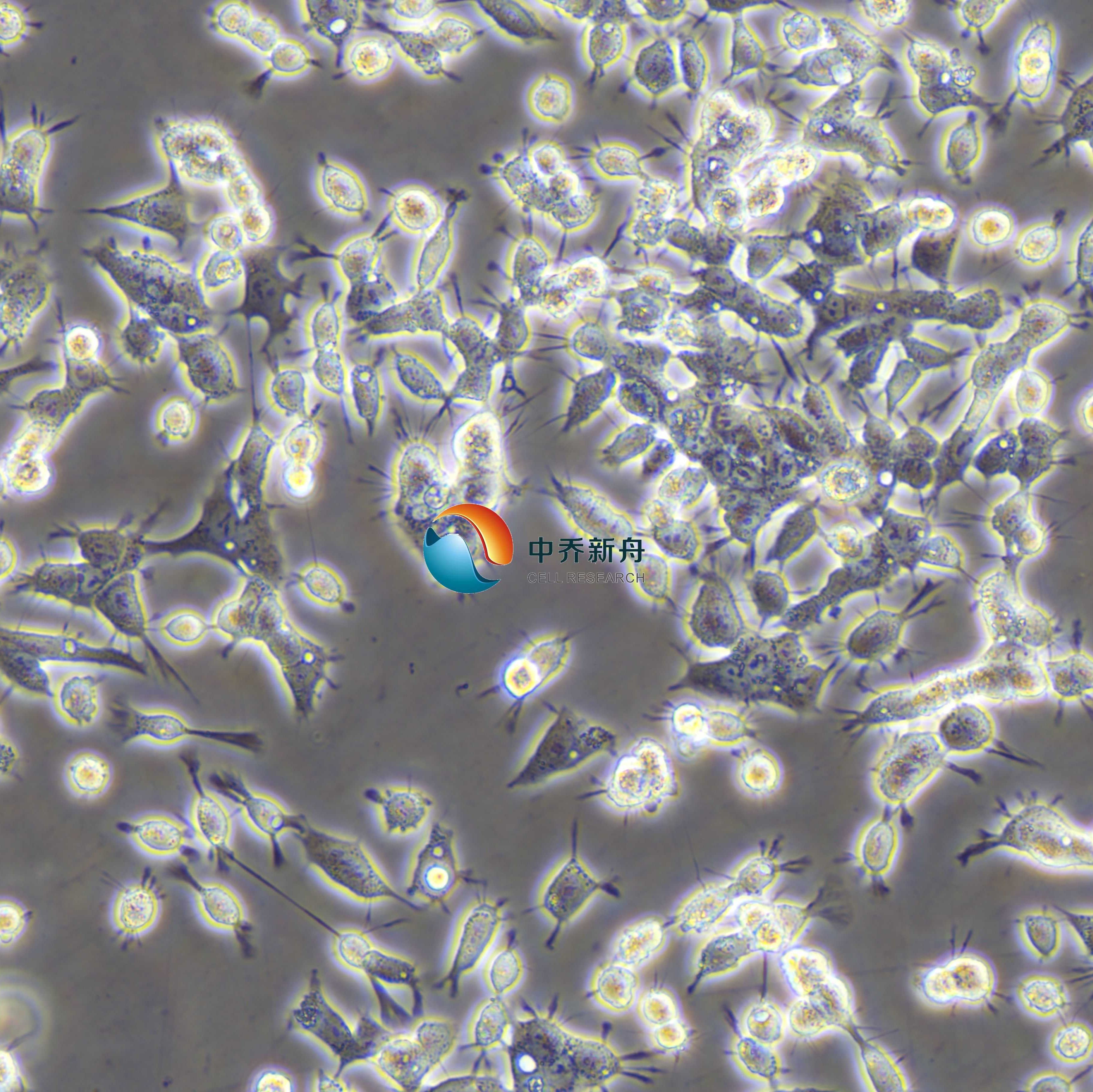 C666-1人鼻咽癌细胞