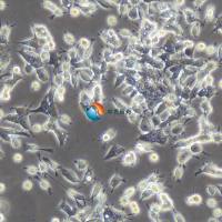 C666-1人鼻咽癌细胞