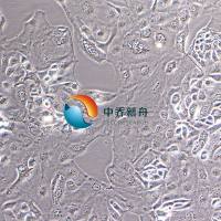 KURAMOCHI人卵巢癌细胞