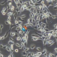 EBC-1人肺癌鳞癌细胞