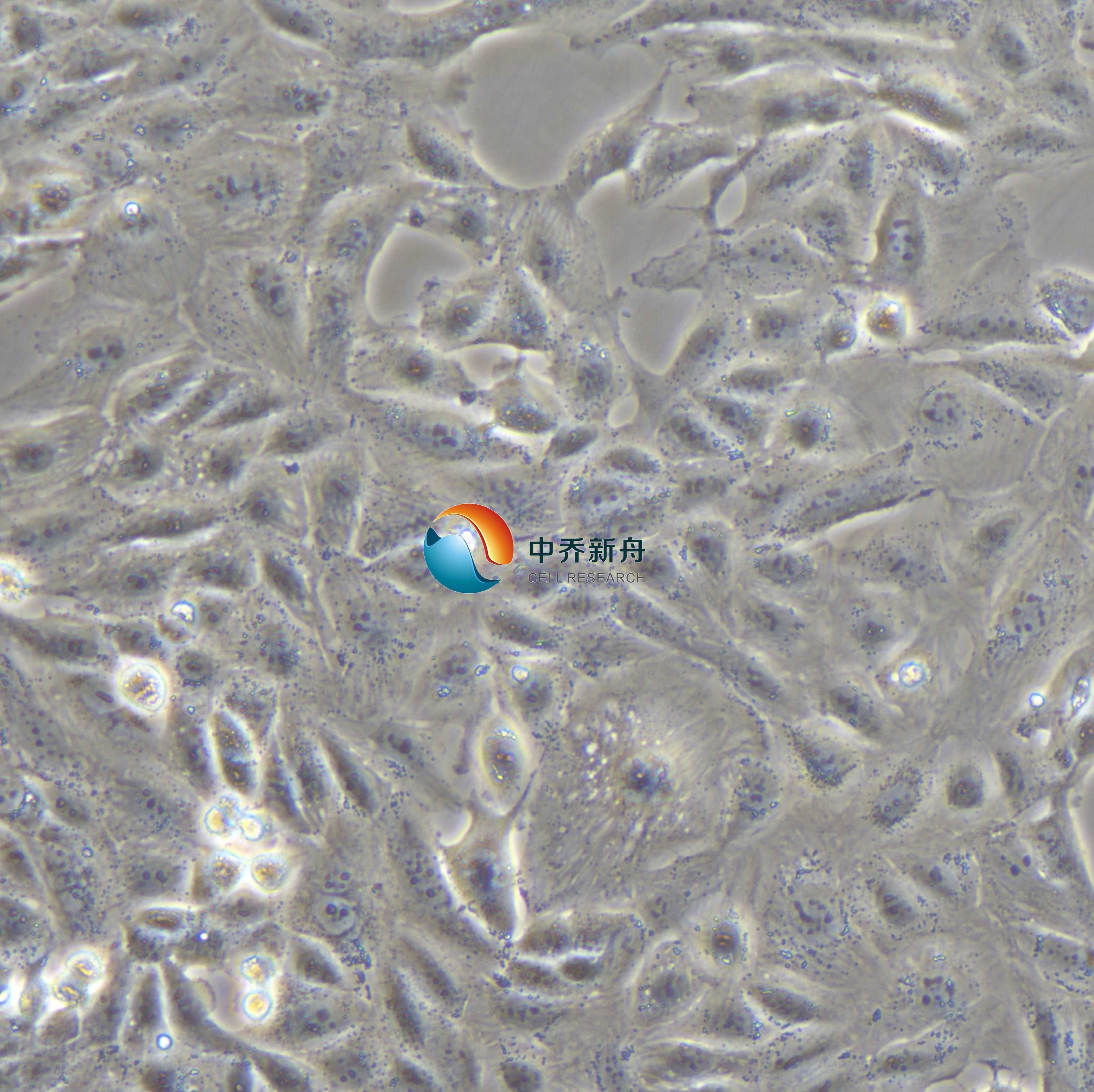 SNU-449人肝癌细胞