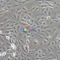 SNU-449人肝癌细胞