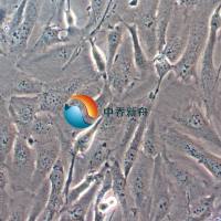 FTC-133人滤泡状甲状腺癌细胞