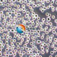 Karpas-299人间变性大细胞淋巴瘤细胞株