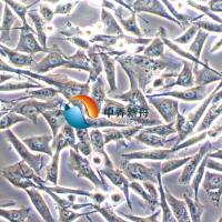 WM-115人恶性黑色素瘤细胞