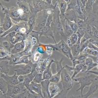 HCC2279人肺腺鳞癌细胞