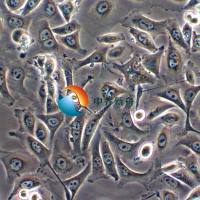 MKN-1人胃癌细胞