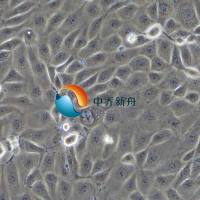 SNU-216人胃癌细胞