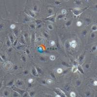 MKN-7人胃癌细胞