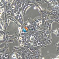 TMK-1人胃癌细胞