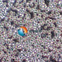 SUP-T1人T淋巴瘤细胞