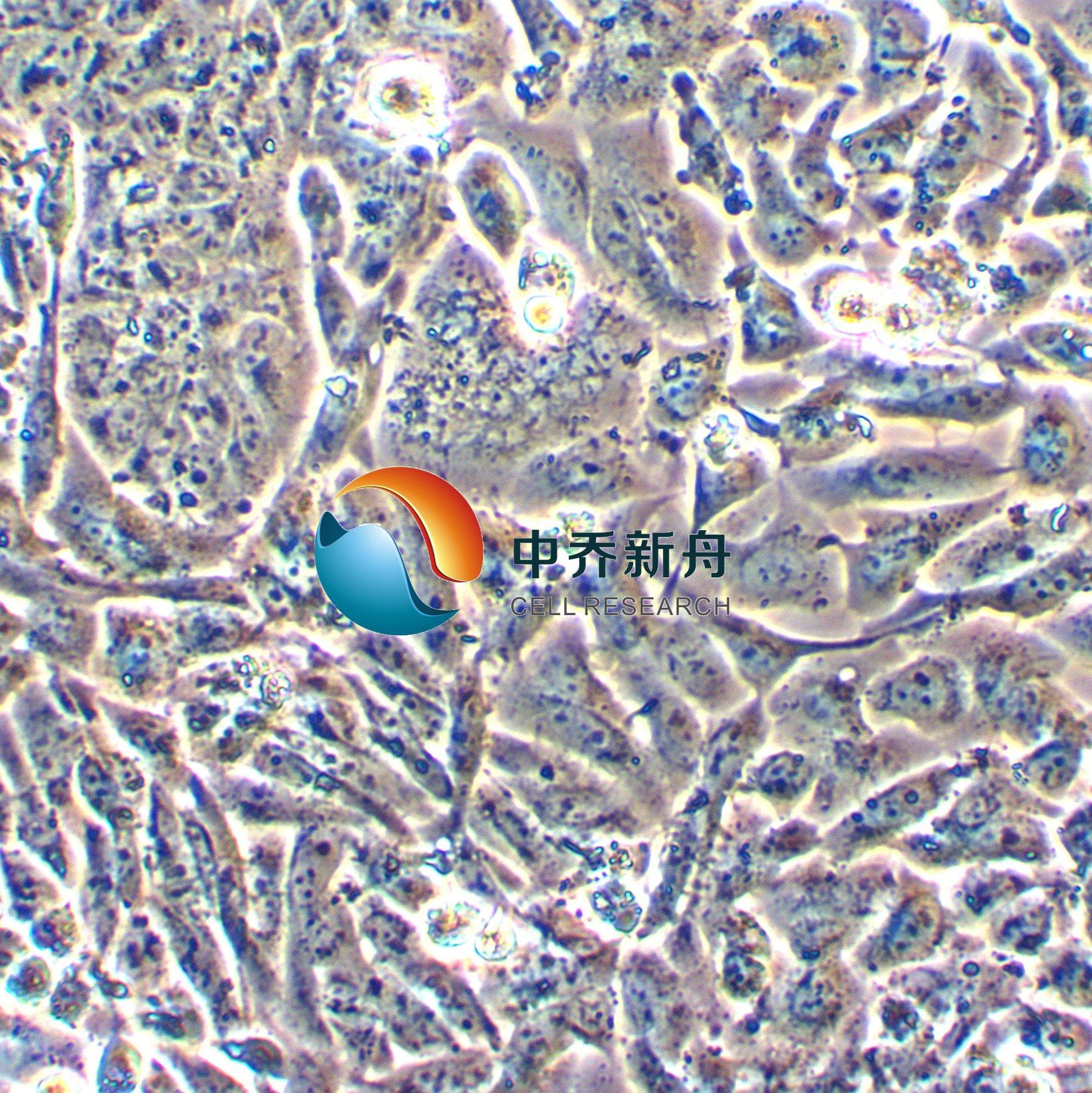 NCI-H522人非小细胞肺癌腺细胞