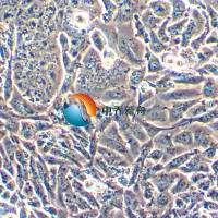 NCI-H522人非小细胞肺癌腺细胞