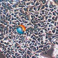 SW948人结肠腺癌细胞