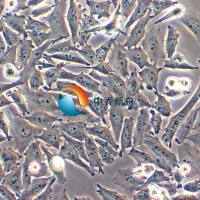 PATU 8988T人胰腺癌细胞