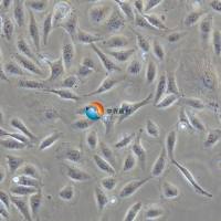 TPC-1 甲状腺乳头状癌细胞株