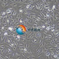 Caki-2人乳头状肾细胞癌细胞