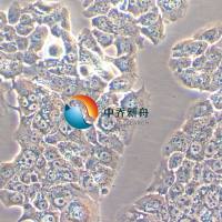 HCC1428人乳腺腺癌细胞