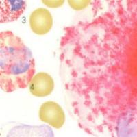 酸性磷酸酶染色