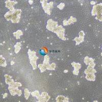 SHP-77人小细胞肺癌细胞