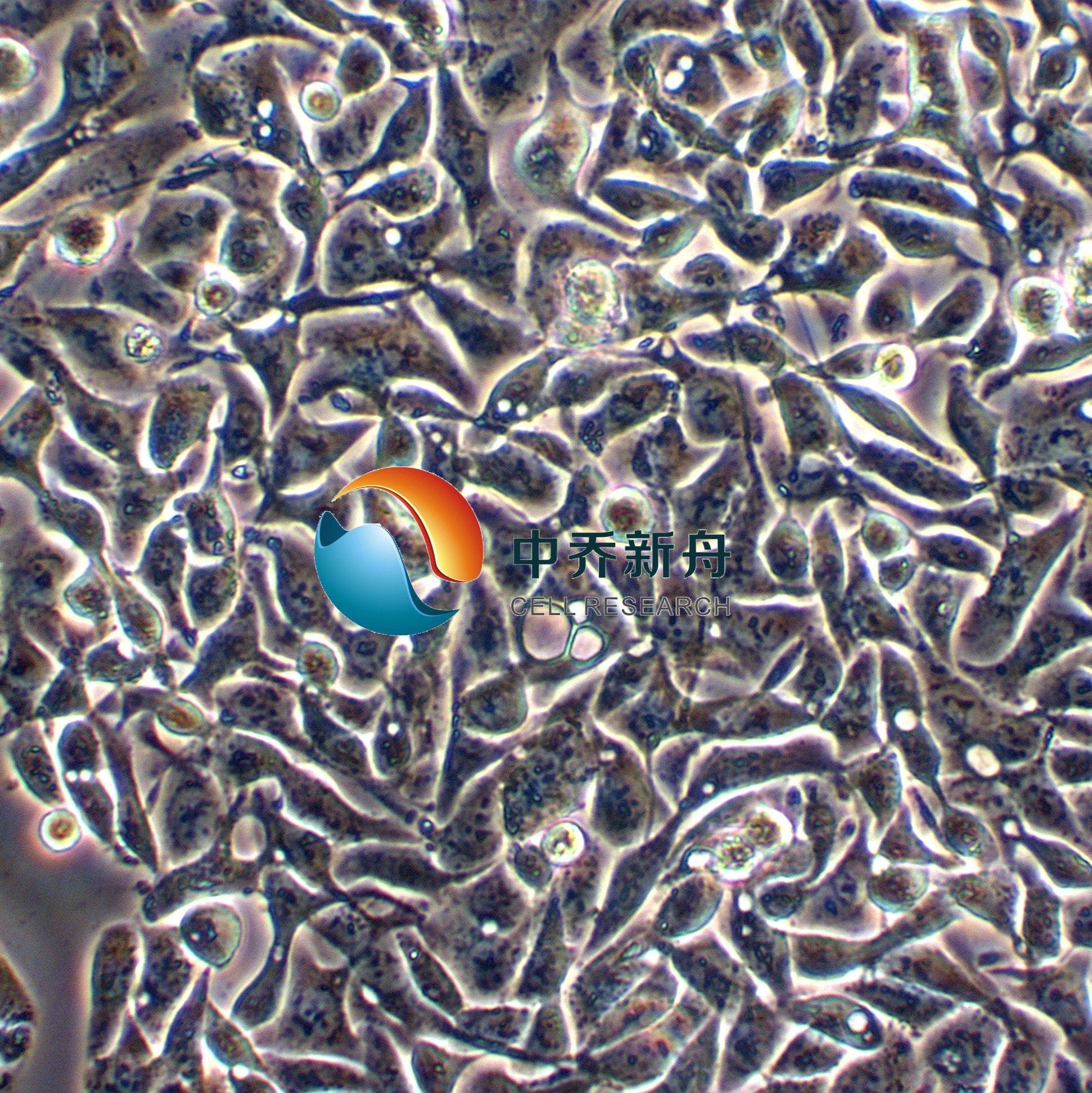 ARO人甲状腺癌细胞