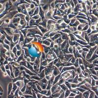 ARO人甲状腺癌细胞