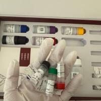 Venezuelan Equine Encephalomyelitis Virus(VEEV)委内瑞拉马脑脊髓炎病毒探针法荧光定量RT-PCR试剂盒