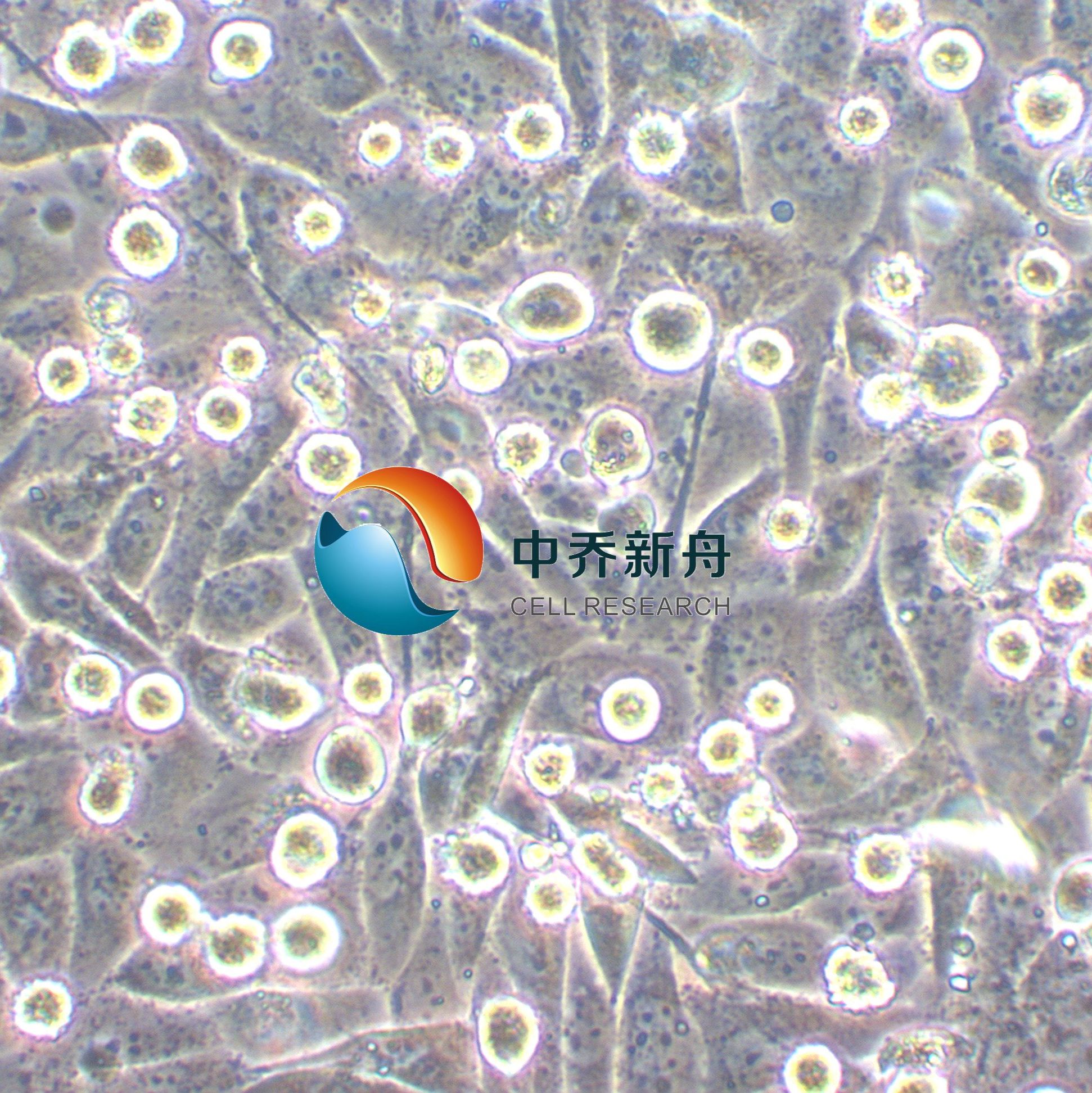 HCC44人非小细胞肺癌细胞