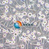 HCC44人非小细胞肺癌细胞