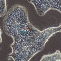 LC-2/AD人肺癌腺癌细胞