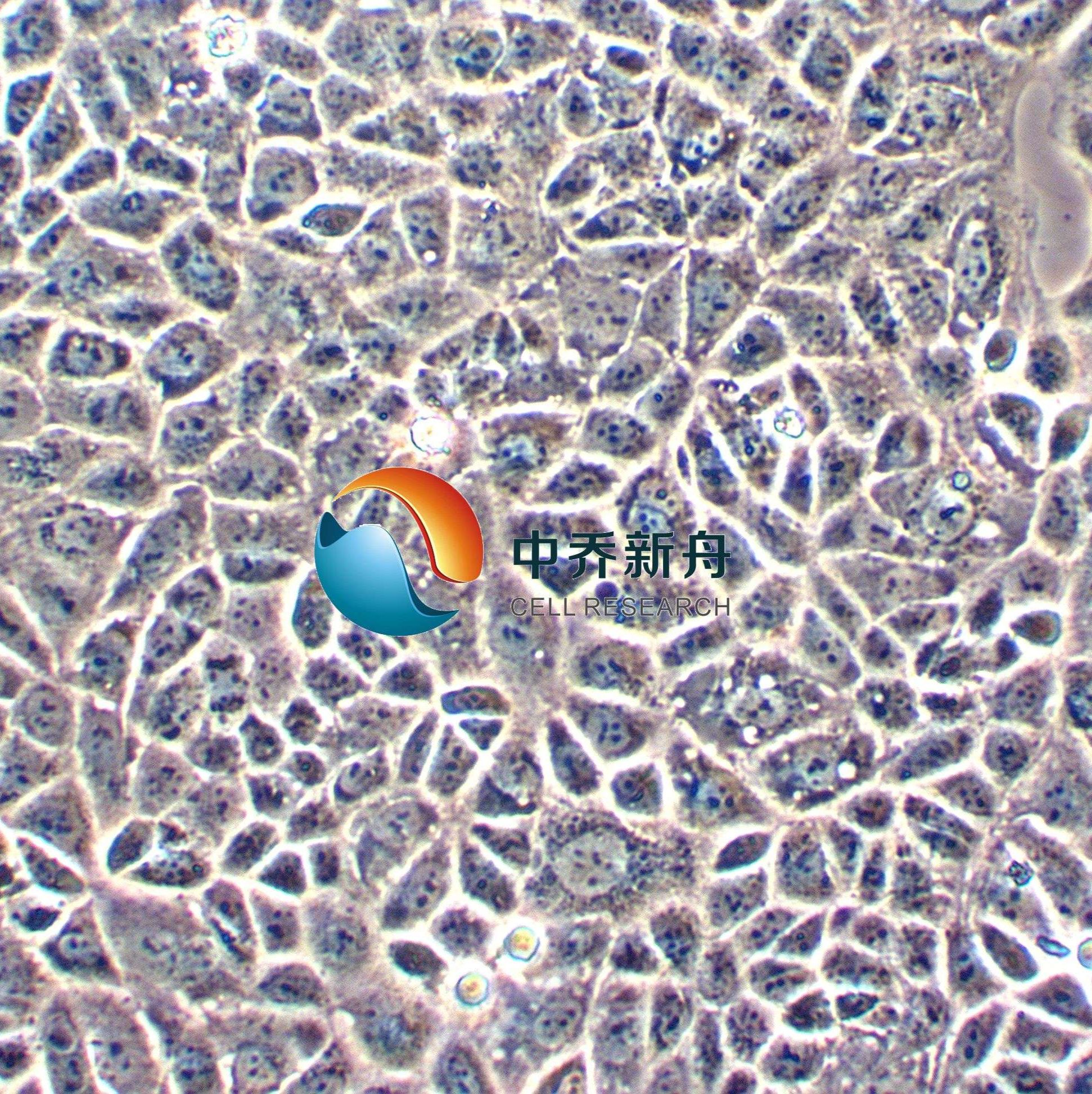 CAL-51人乳腺癌细胞