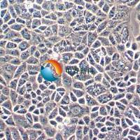 CAL-51人乳腺癌细胞