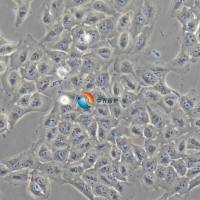 Nthy-ori 3-1人甲状腺正常细胞